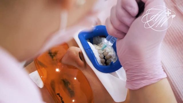 Отбеливание Zoom 4 в Hemeda Clinic