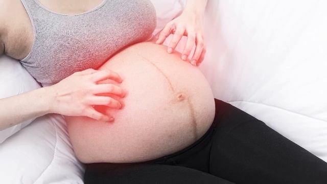 ЗУД КОЖИ ВО ВРЕМЯ БЕРЕМЕННОСТИ | Почему постоянно чешется кожа и что с этим делать смотреть онлайн