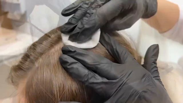 Фототрихограмма как ценная диагностическая методика на приеме врача-трихолога смотреть онлайн