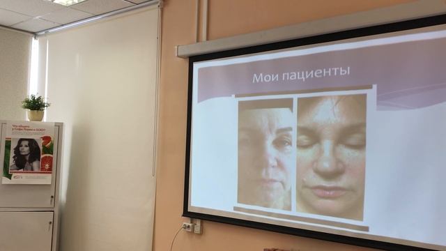 Идеальное сочетание Red Peel с ревитализацией смотреть онлайн