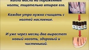 Грибок ногтей? ! Будем избавляться!