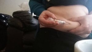 Zoladex injection