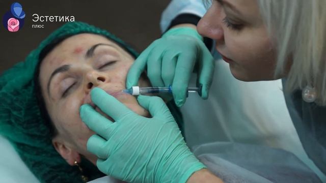 Коррекция лица препаратом Биоэкспандер: full-face. Методы введения