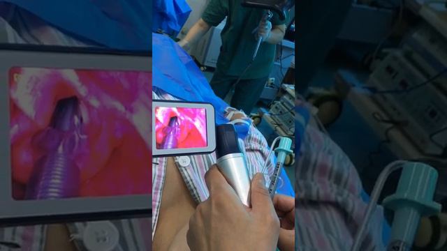 Anesthesia Video Laryngoscope MSLVL06