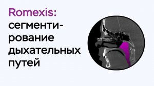 Возможности программы Romexis Viewer: сегментирование дыхательных путей