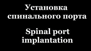 Установка спинального порта / spinal port implantation