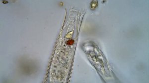 Metacystis (Freshwater variety of Metacystis annulata ? )