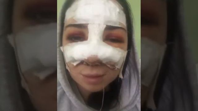 Суровая ринопластика Маши смотреть онлайн