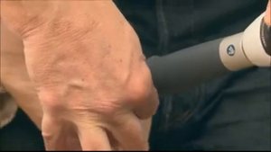 Лечение плантарного фасциита, "Пяточной шпоры"