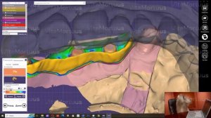 анатомия зубов моделировка в экзокад атачмены импланты стоматология зубные техники зубы балка