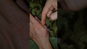 Как вытащить жало пчелы?