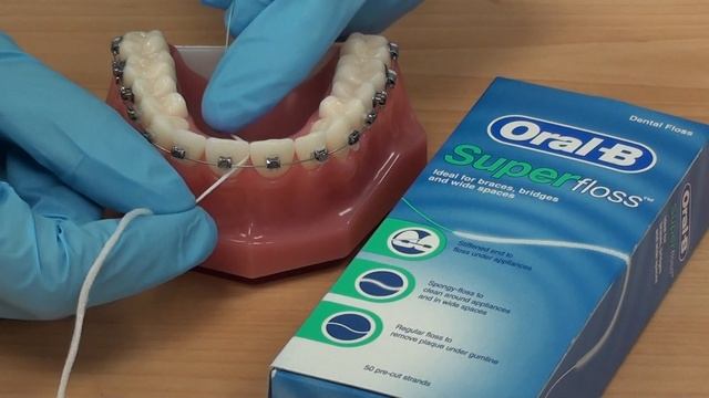 How to use Superfloss with fixed braces. смотреть онлайн