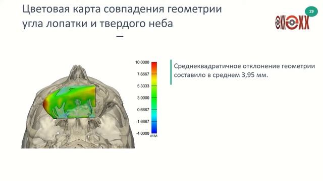 Междисциплинарный подход и комплексная реабилитация в ЛОР онкологии
