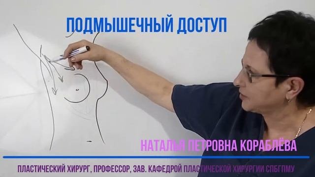 Подмышечный доступ в маммопластике