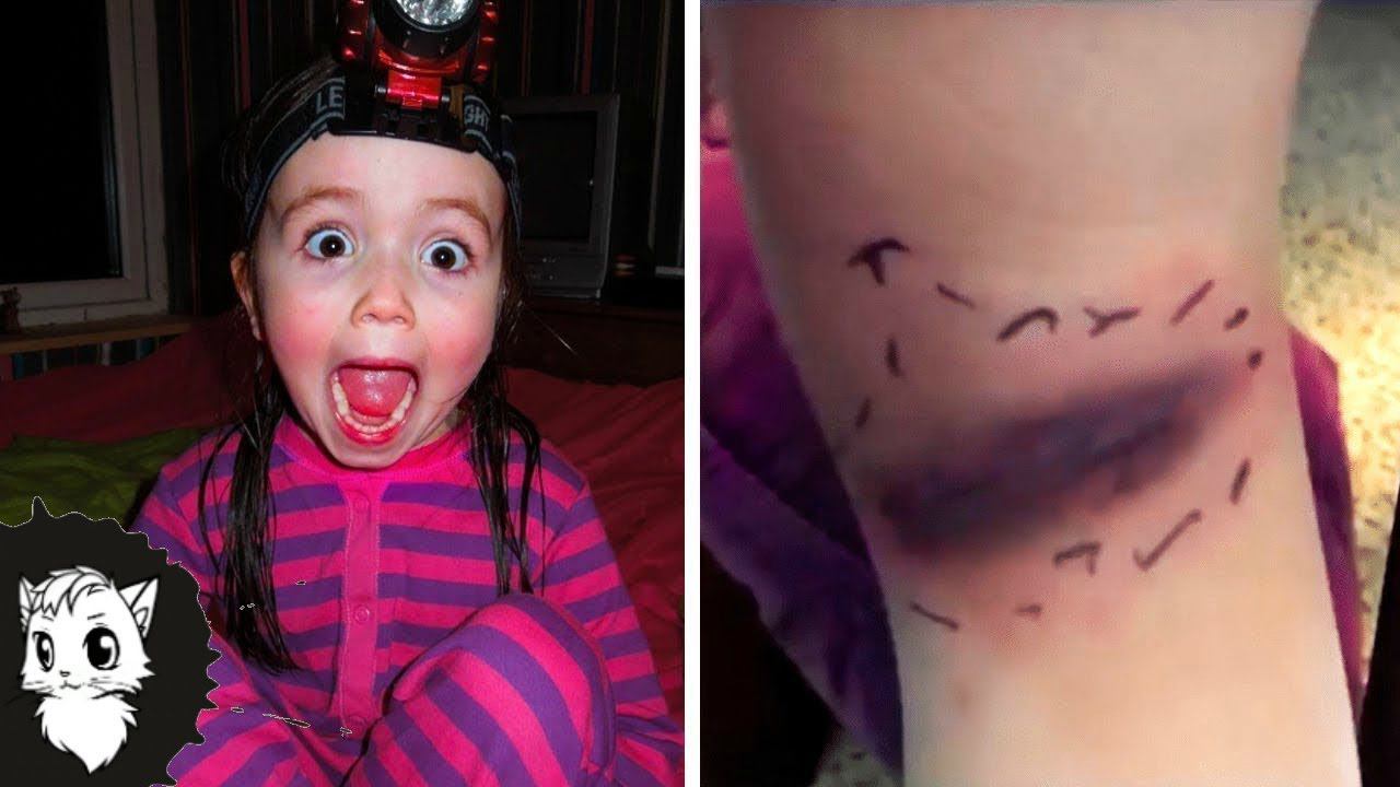 РОДИТЕЛИ УВИДЕЛИ СИНЯК, НО ВРАЧИ РАСКРЫЛИ УЖАСНУЮ ПРАВДУ [Белый кот] смотреть онлайн