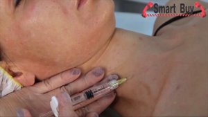 Биоревитализация