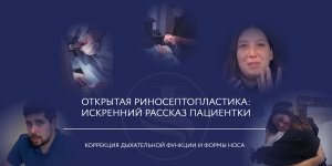 Риносептопластика: хирург подарил девушке нос ее мечты и восстановил нормальное дыхание