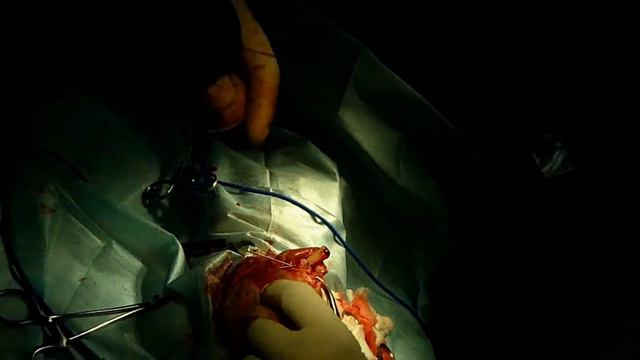 Остеосинтез. Реконструкция бедренной кости кошки. Ветклиника Инновет. смотреть онлайн