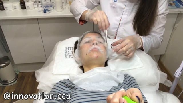 АЛМАЗНАЯ МИКРОДЕРМАБРАЗИЯ. КАРБОКСИТЕРАПИЯ / САМЫЙ КРУТОЙ КОСМЕТОЛОГ!!!