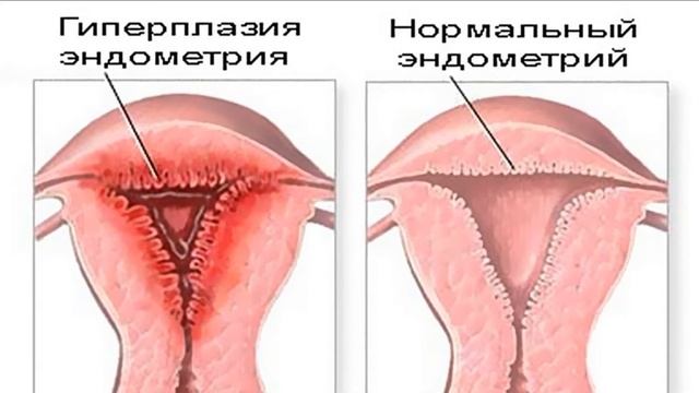 Почему эмбрион не прикрепляется?