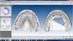 MAESTRO 3D ORTHO STUDIO VERSION 2 DEMONSTRATION