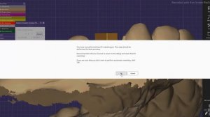 Секреты Exocad - Замена библиотеки в v3 0