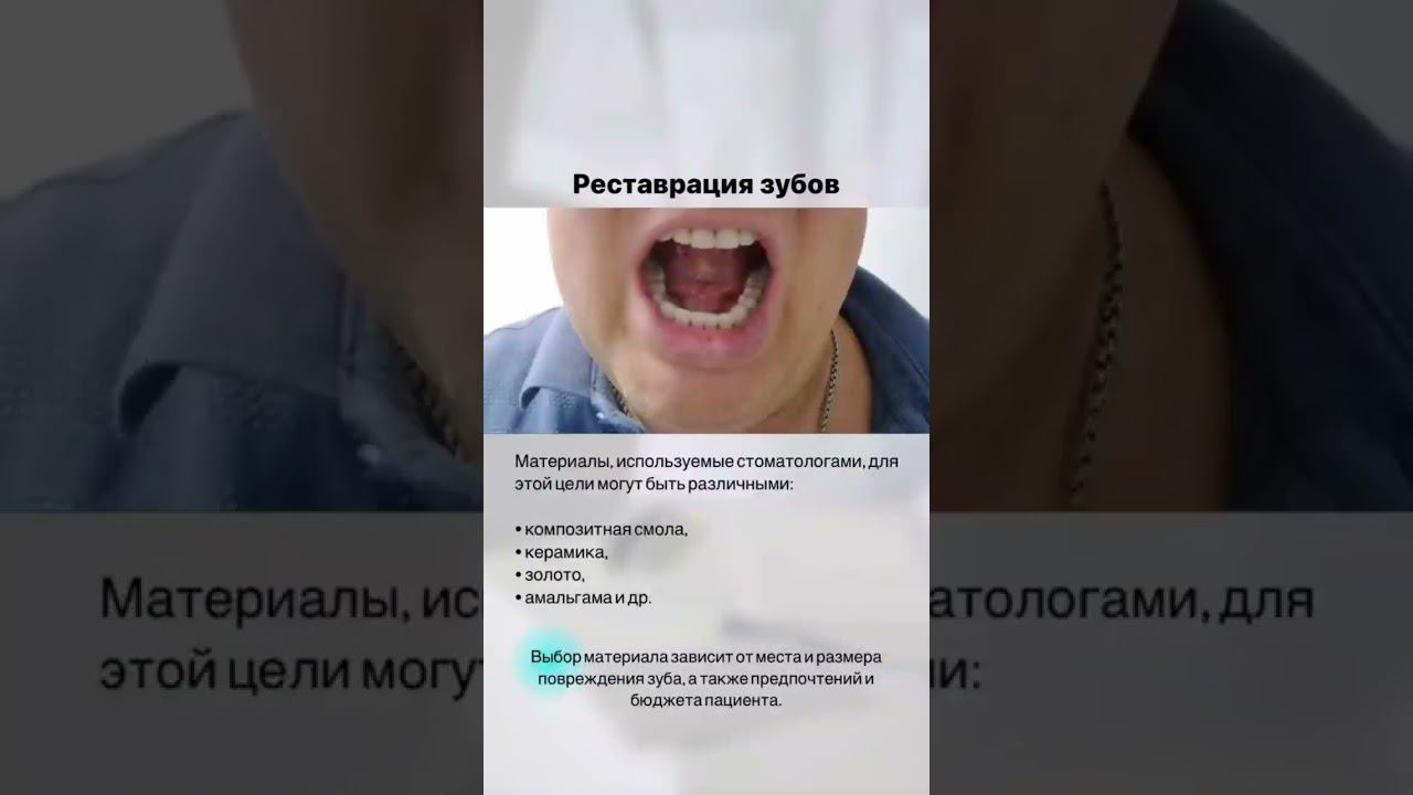 Реставрация переднего зуба или восстановление импланта #имплантация #зубы #стоматолог #shorts