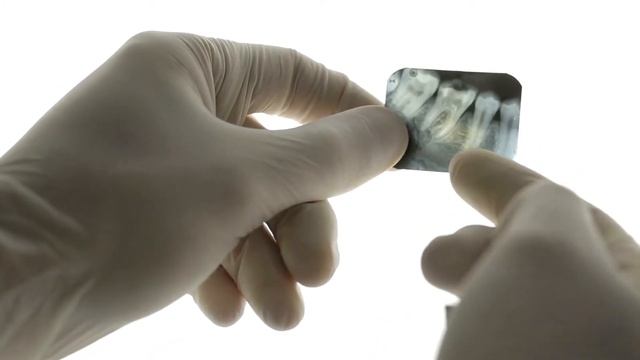 How Your Oral Hygiene Regimen Could Be Causing You Harm! смотреть онлайн