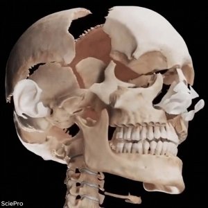 Кости черепа(