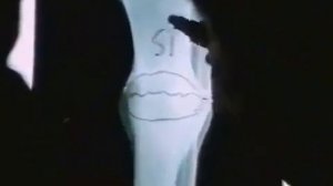 Этот минерал спасёт тебе жизнь, 2022 Кремний Дефицит. Кальций не влияет на прочность костей