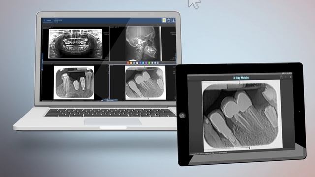 X Ray Mobile смотреть онлайн