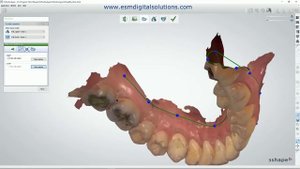 Preparing files for 3D printing with 3Shape OrthoAnalyzer