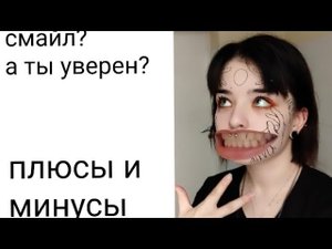 Плюсы и минусы пирсинга смайл (прокол уздечки)