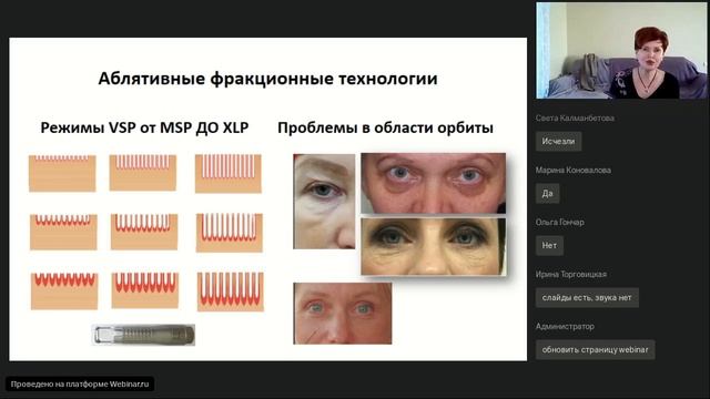 Периорбитальная зона  Использование лазерных технологий  новые возможности.