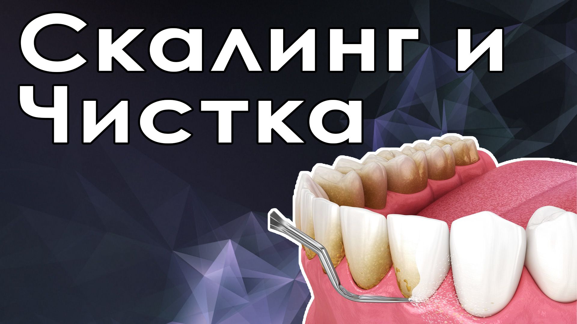 Пескоструйная чистка зубов и скалинг