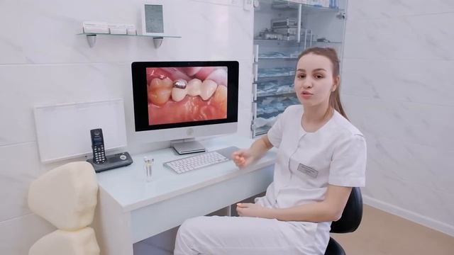 МОСТЫ НА ЗУБЫ | Опасность установки мостовидных протезов. Мнение стоматолога смотреть онлайн