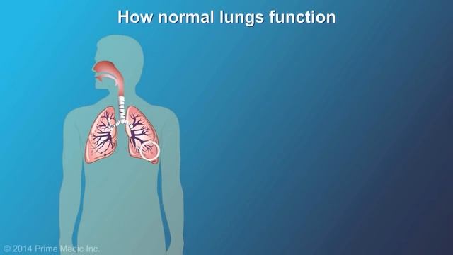 Understanding COPD смотреть онлайн