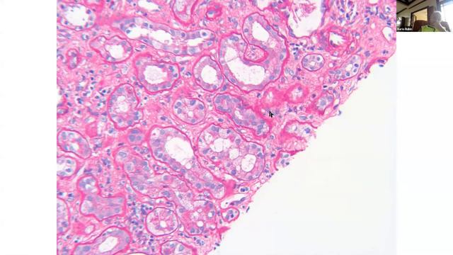 RUMC-RBC November 18th, 2021 смотреть онлайн