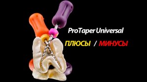 Протейперы юниверсал плюсы и минусы, конусность протейперов юниверсал, показания и противопоказания