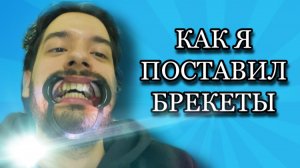 Как я поставил Брекеты