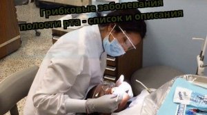 Грибковые заболевания полости рта - список и описания