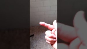 Применение зубной пасты компании Глобал Тренд при ожогах,ранах.14.02.22г.