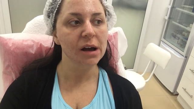 КАК ИЗБАВИТЬСЯ ОТ ВТОРОГО ПОДБОРОДКА ЗА 1 ДЕНЬ ! ЛИПОЛИТИКИ.
