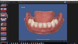 Онлайн-консультация по имплантации в Эстетикс