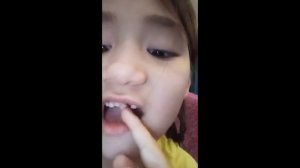 Как у меня выпал  зуб