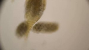 Вода под микроскопом. Water under microscope.