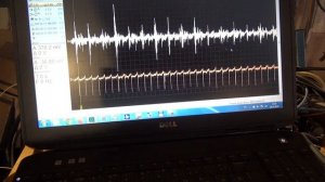 Тойота  1MZ-FE ошибка Р0330 по датчику детонации - разгадка найдена! Проверка датчиков детонации.