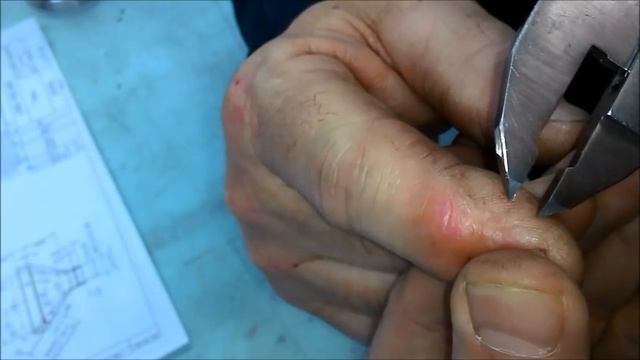 Не пропусти! Как достать занозу, Самый быстрый метод!!! смотреть онлайн