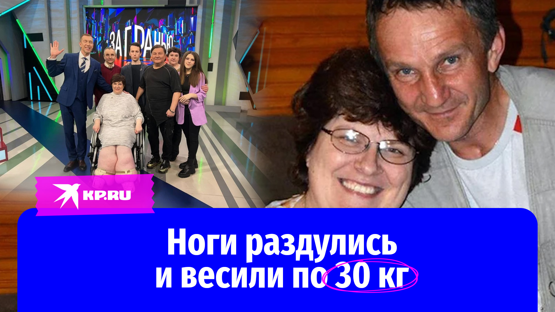 «Ты у меня одна»: муж ухаживал за женой, у которой жутко раздулись ноги