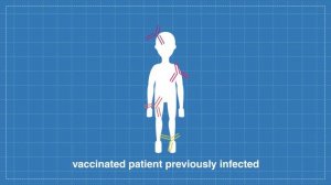 The multiplex edge: investigating SARS-CoV-2 vaccine responses at São João Hospital